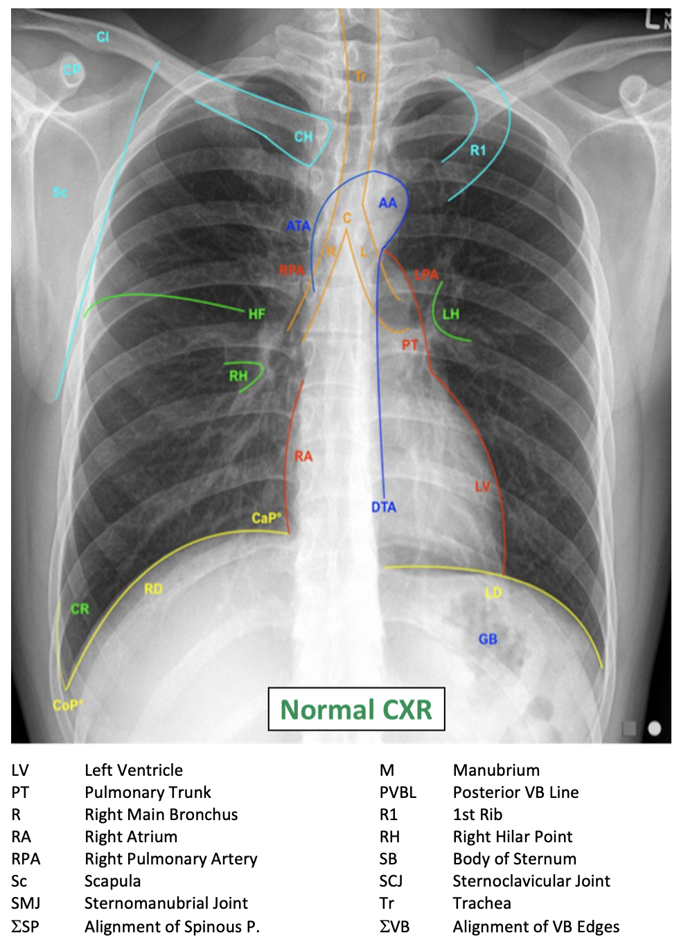 CXR