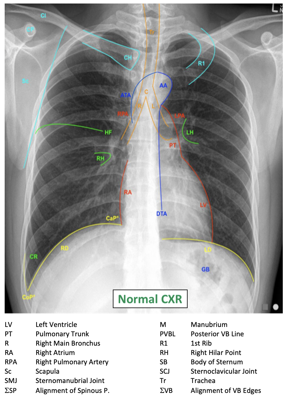 Chest XR Interpretation EMcyclopedia Chest XR Interpretation EMcyclopedia