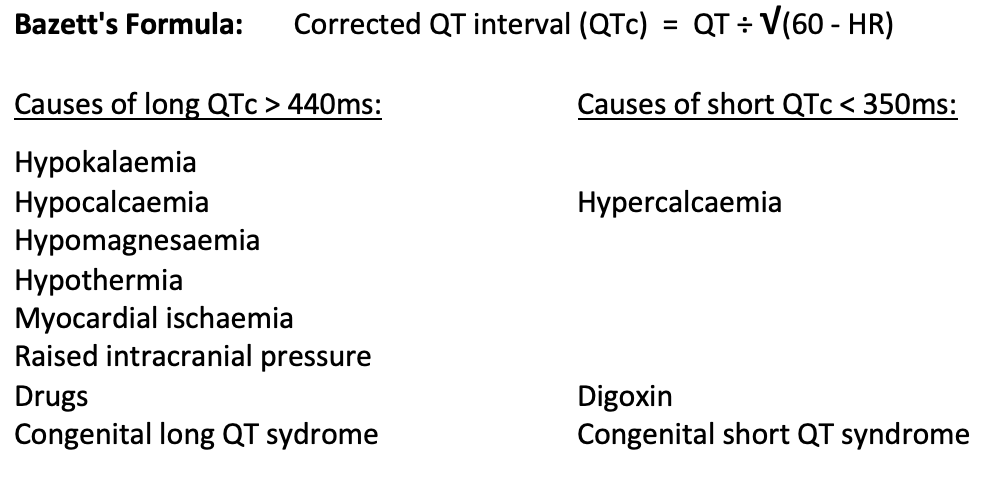 Qt Interval