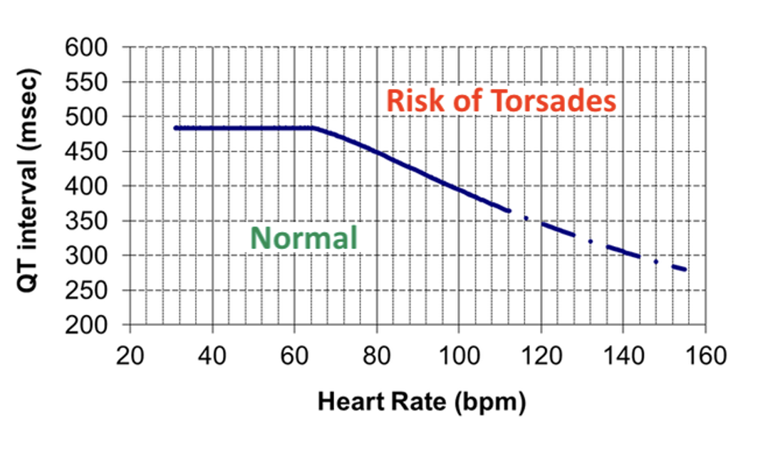 Qt Interval 2