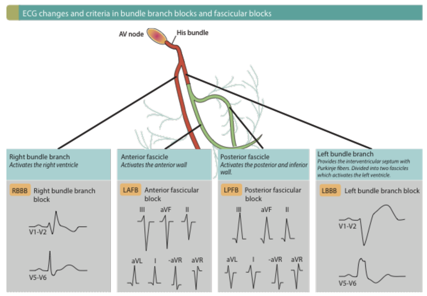 ST Segment and T Wave Abnormalities