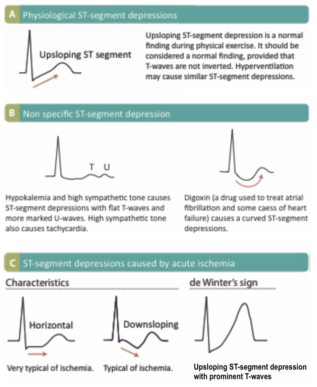 ST Segment and T Wave Abnormalities