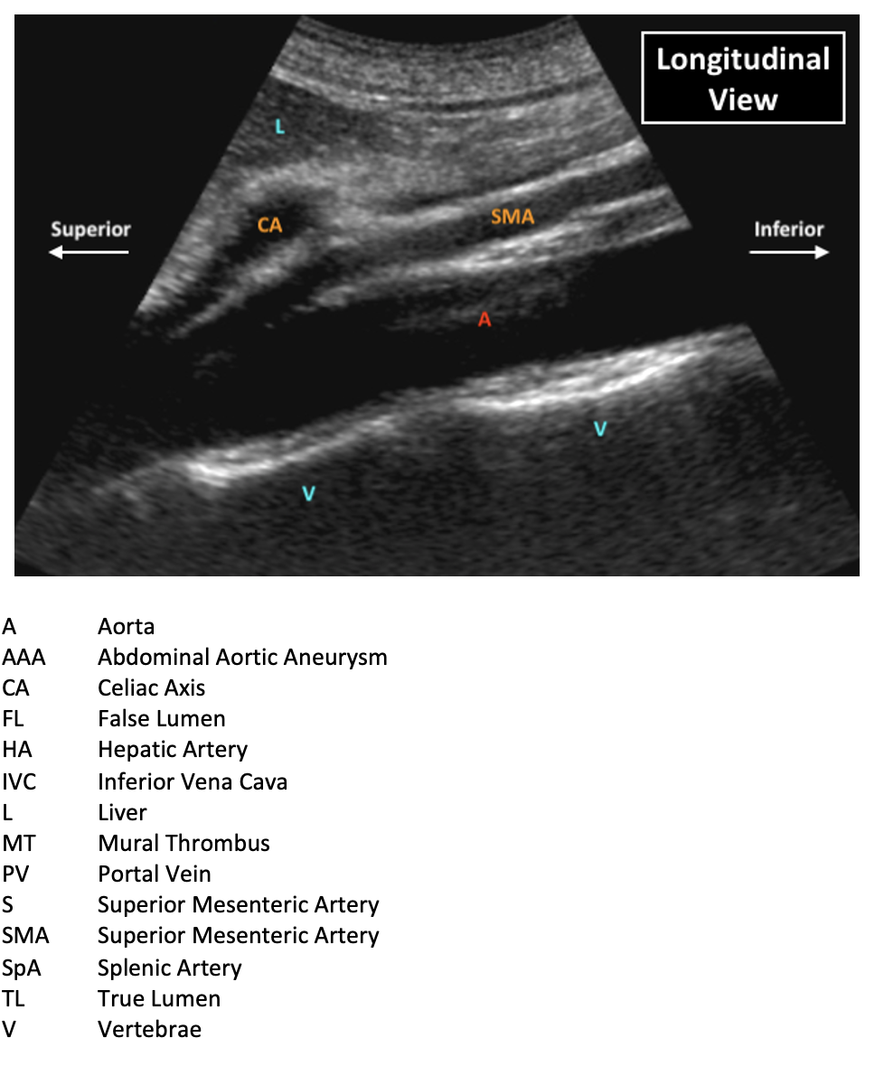 Ultrasound Of The Abdominal Aorta