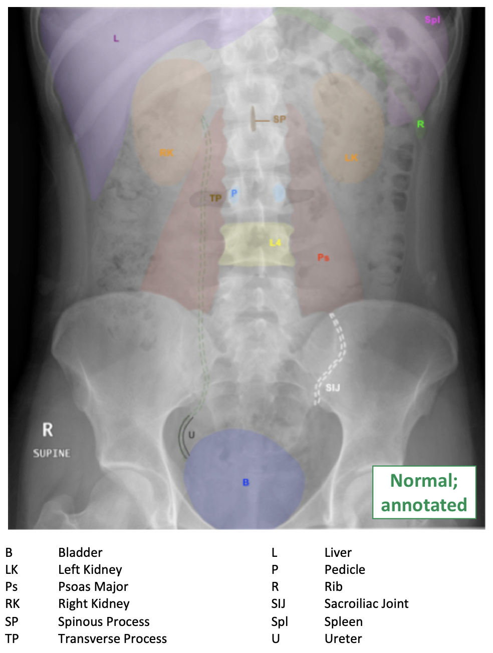 Abdominal XRay Interpretation 2