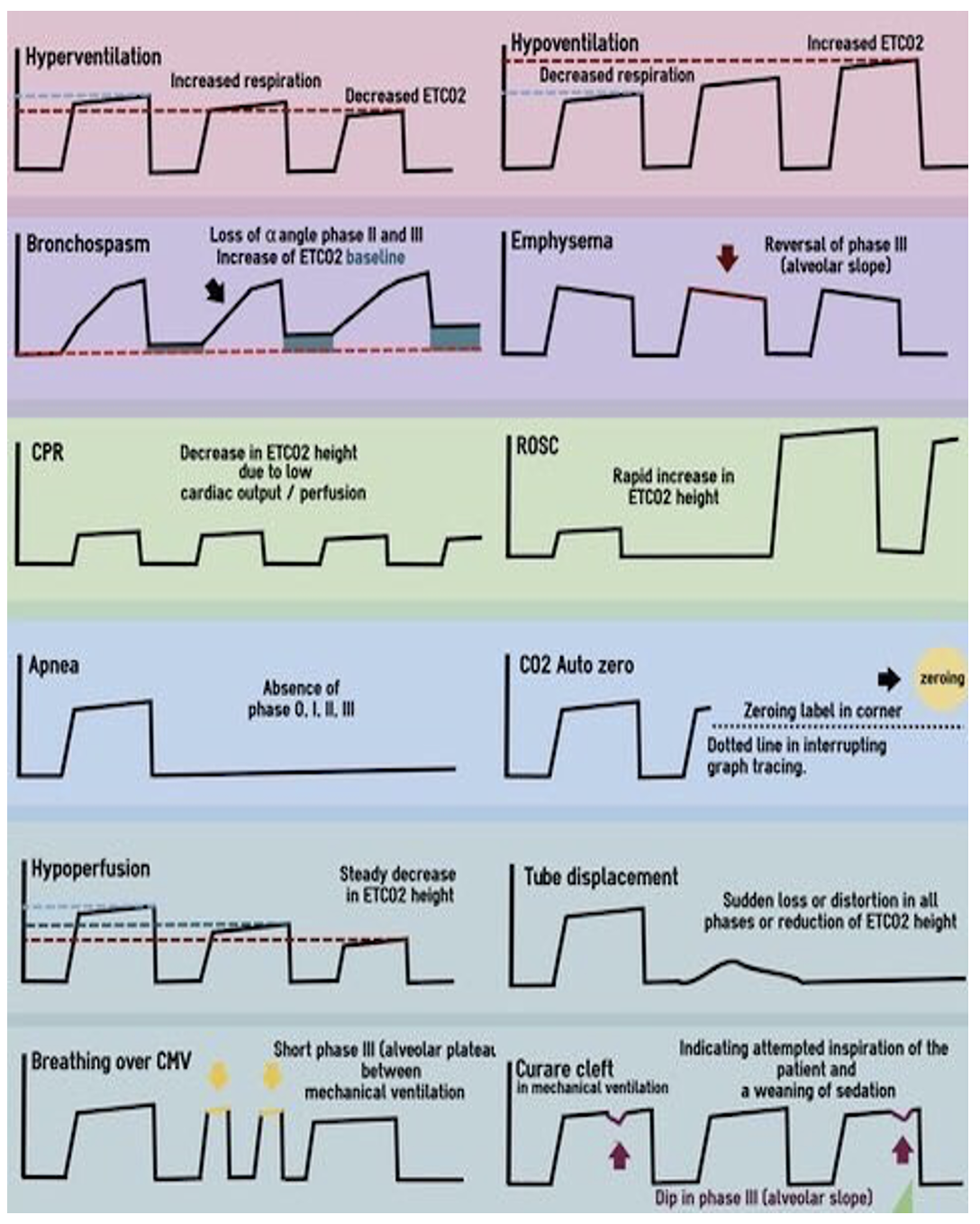 Capnography