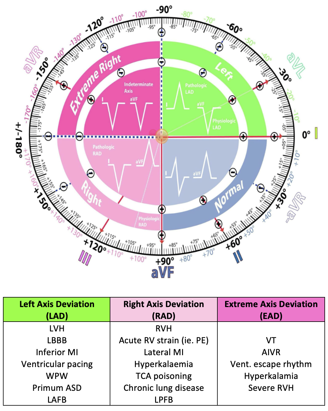 Cardiac Axis Bundle Branch Blocks