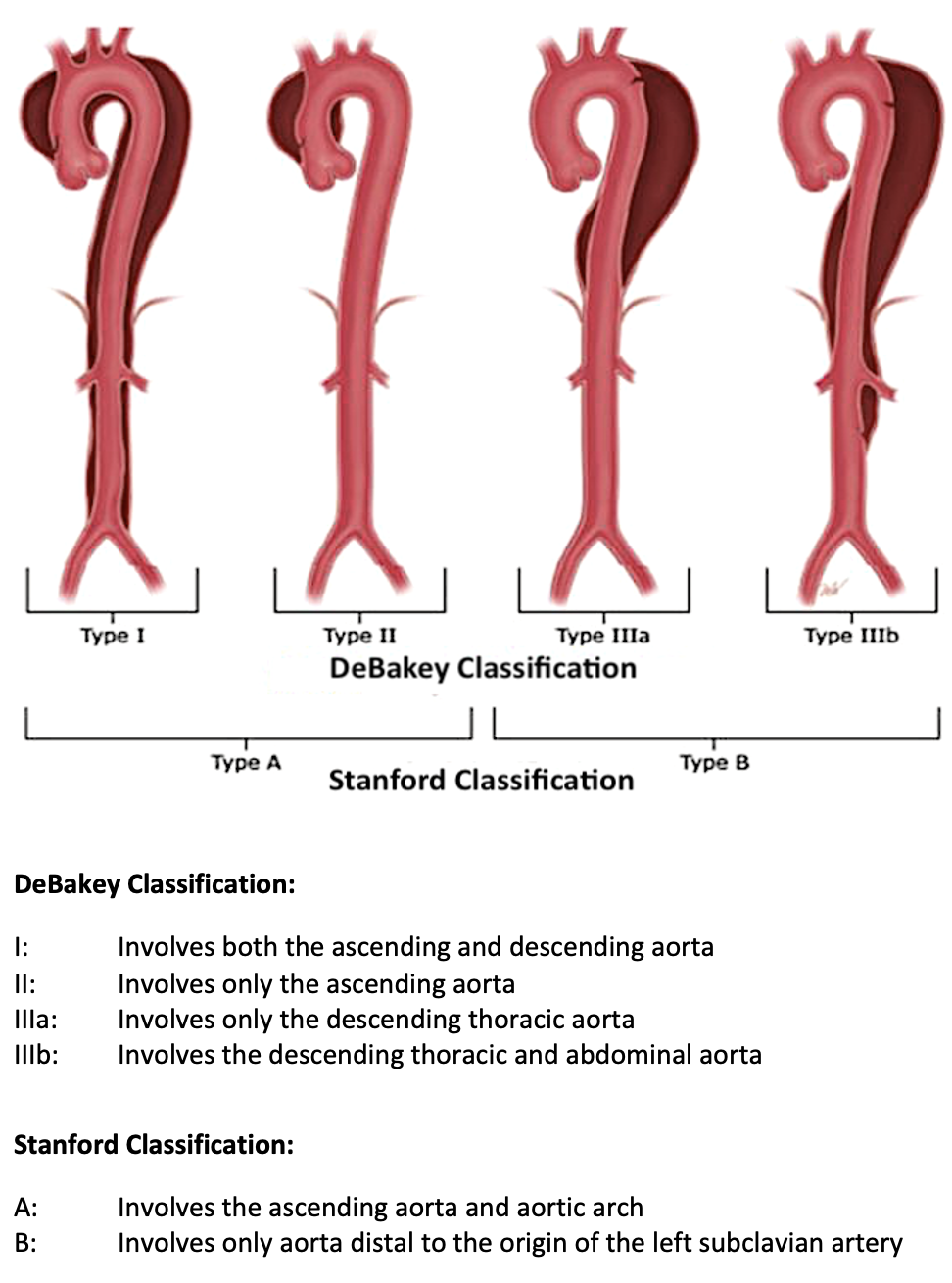 Classification Of Aortic Dissections