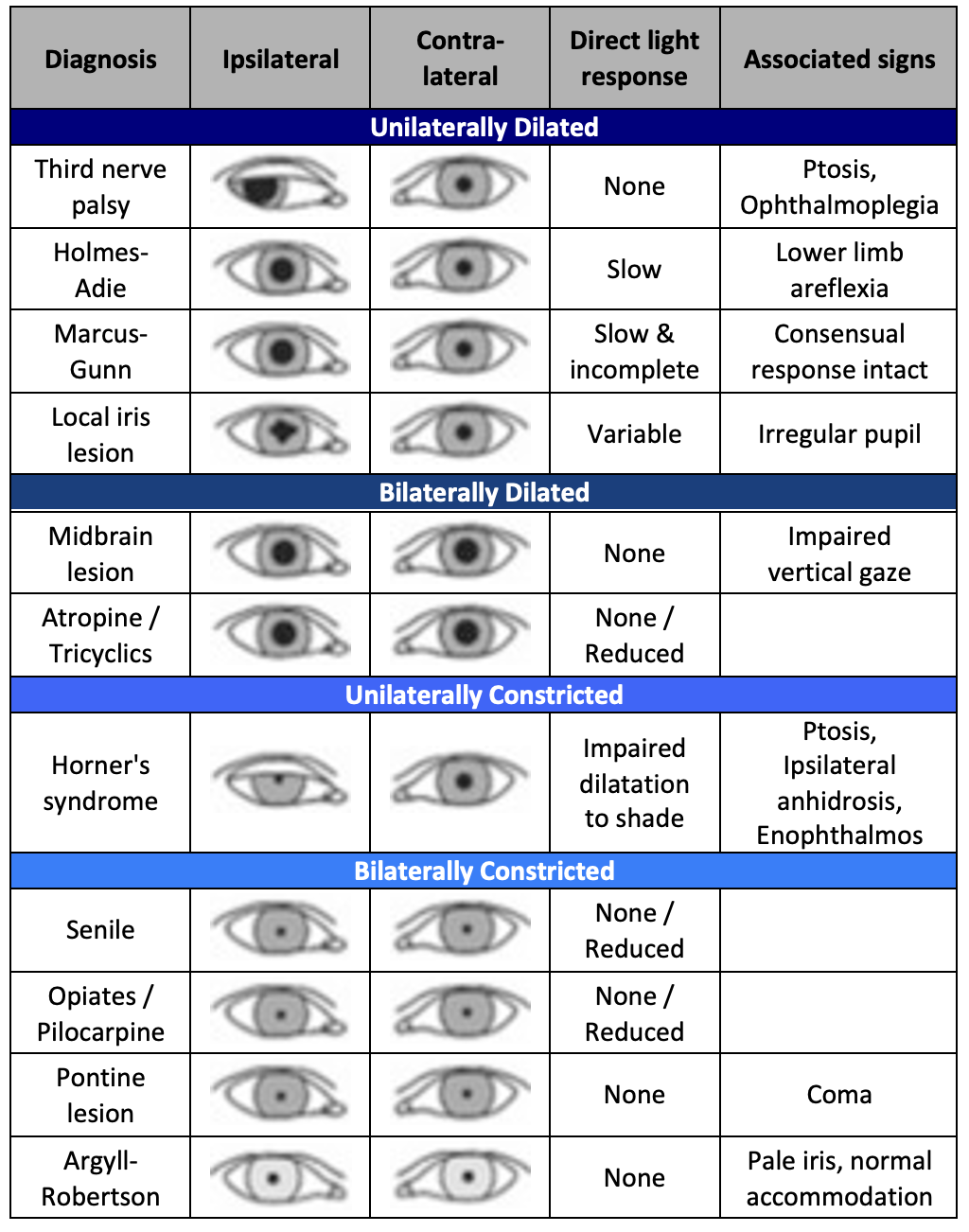 Pupillary Abnormalities | EMcyclopedia